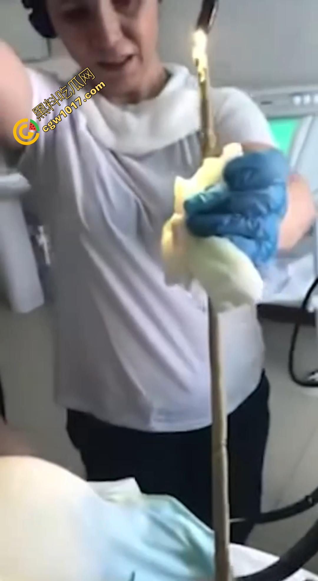 俄罗斯医院活拽1米毒蛇!女患者吞蛇卵孵化钻喉,医生手抖拽出瞬间到处乱窜!-3