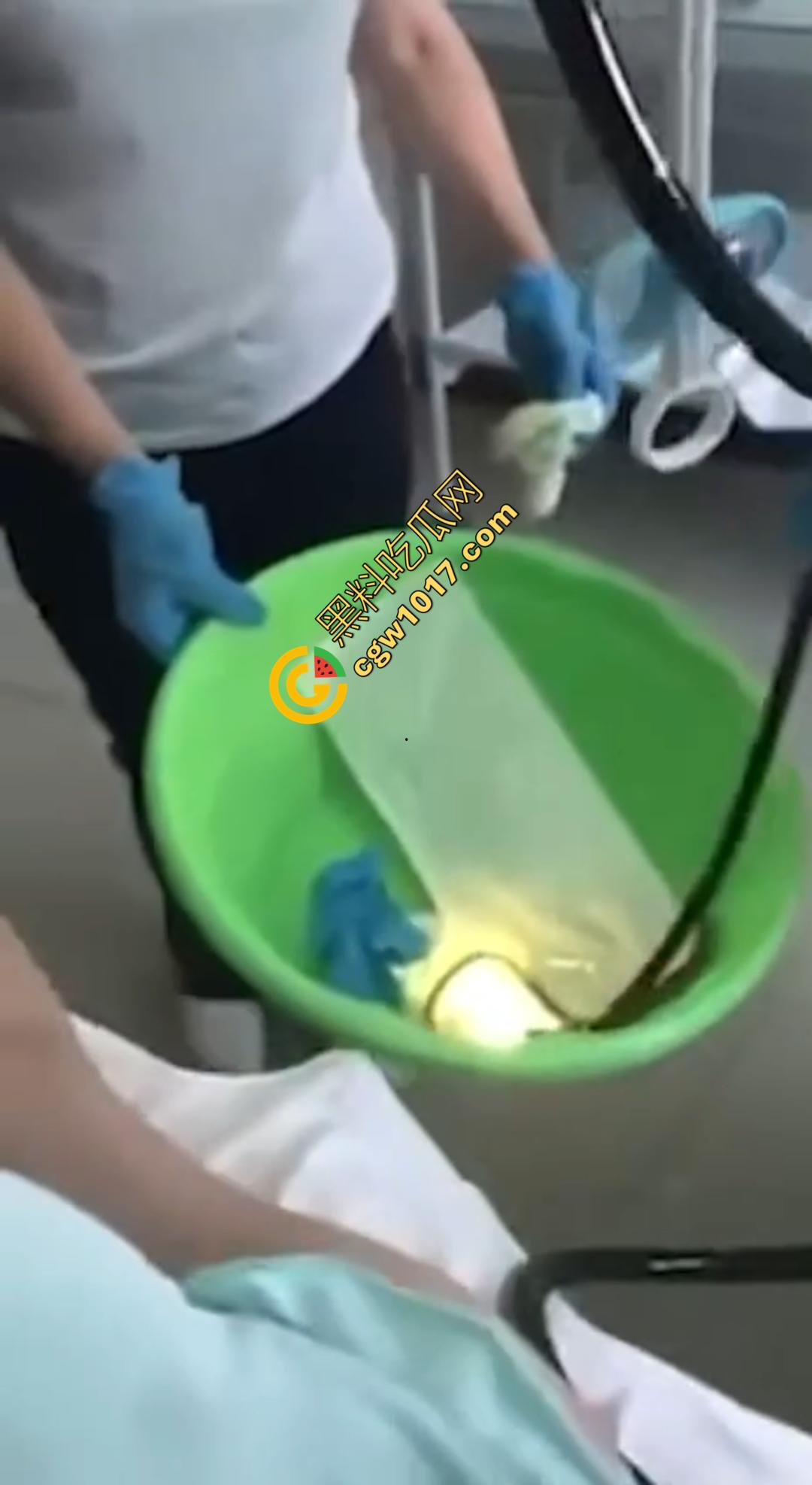 俄罗斯医院活拽1米毒蛇!女患者吞蛇卵孵化钻喉,医生手抖拽出瞬间到处乱窜!-6
