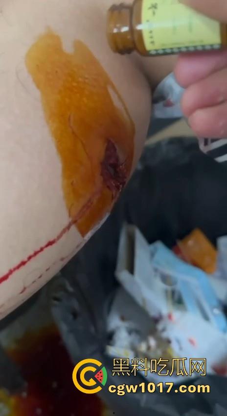 妙瓦底顺达园区缅甸KUN武装屠杀中国人!抢劫、轮奸、枪杀地盘之争,诈骗人员沦落为牺牲品,这时候你是中国人啦!-9