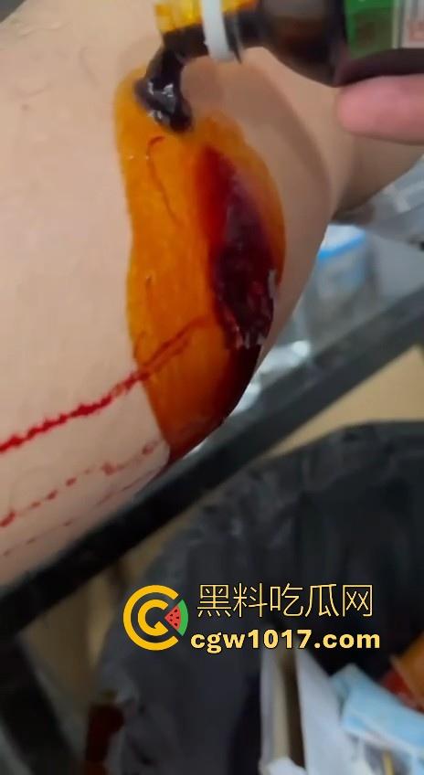 妙瓦底顺达园区缅甸KUN武装屠杀中国人!抢劫、轮奸、枪杀地盘之争,诈骗人员沦落为牺牲品,这时候你是中国人啦!-11