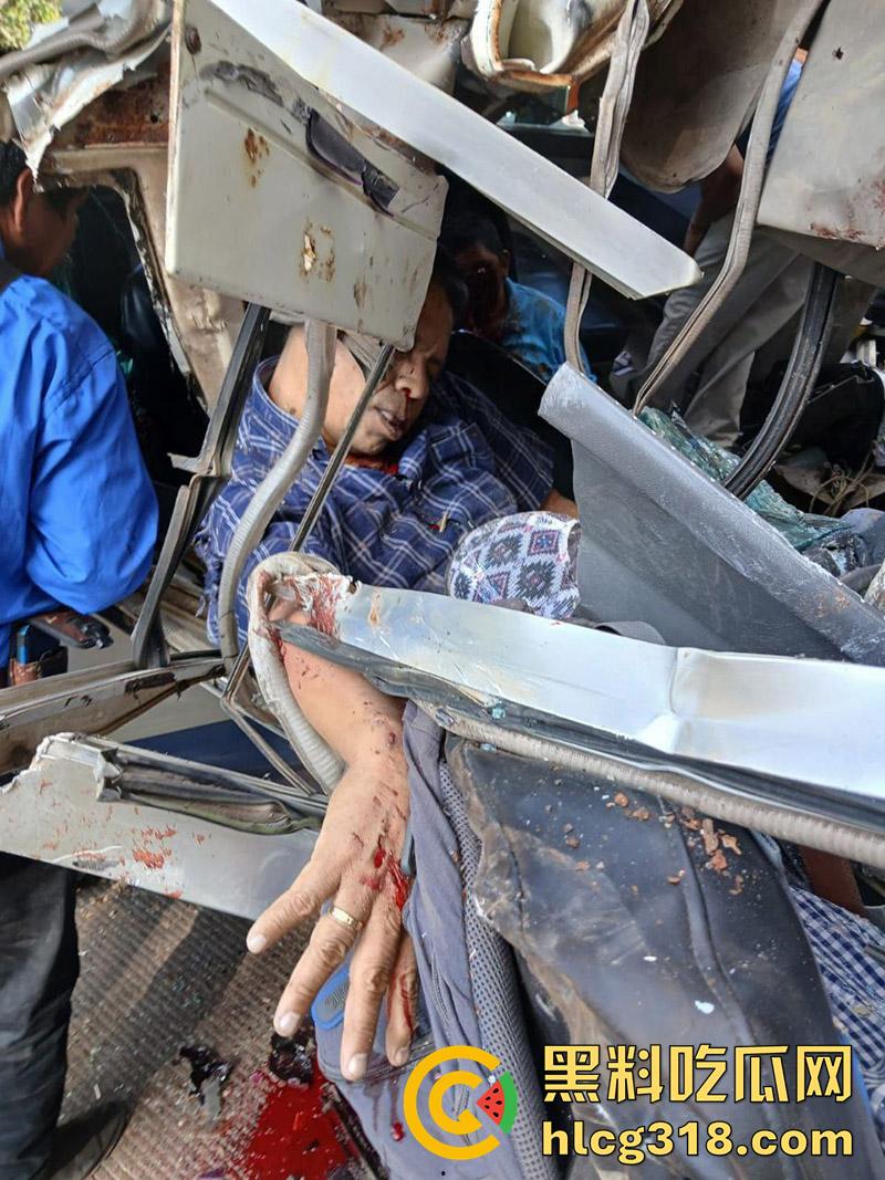 车祸没死脸却没了！印尼发生惨烈车祸，超速行驶失控撞上货车，乘客全部死亡司机面目全非！-6