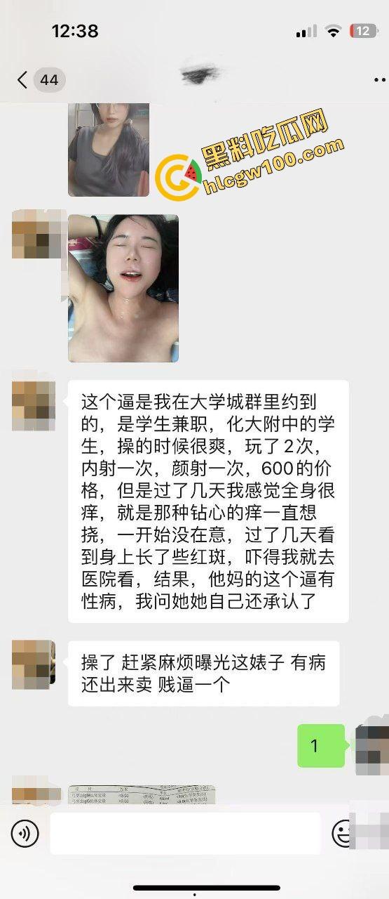 瓜友独家投稿曝光生化母体!化大附中卖淫骚鸡【余纯】600约炮单男,黑丝操逼颜射贱脸!独家流出!-1