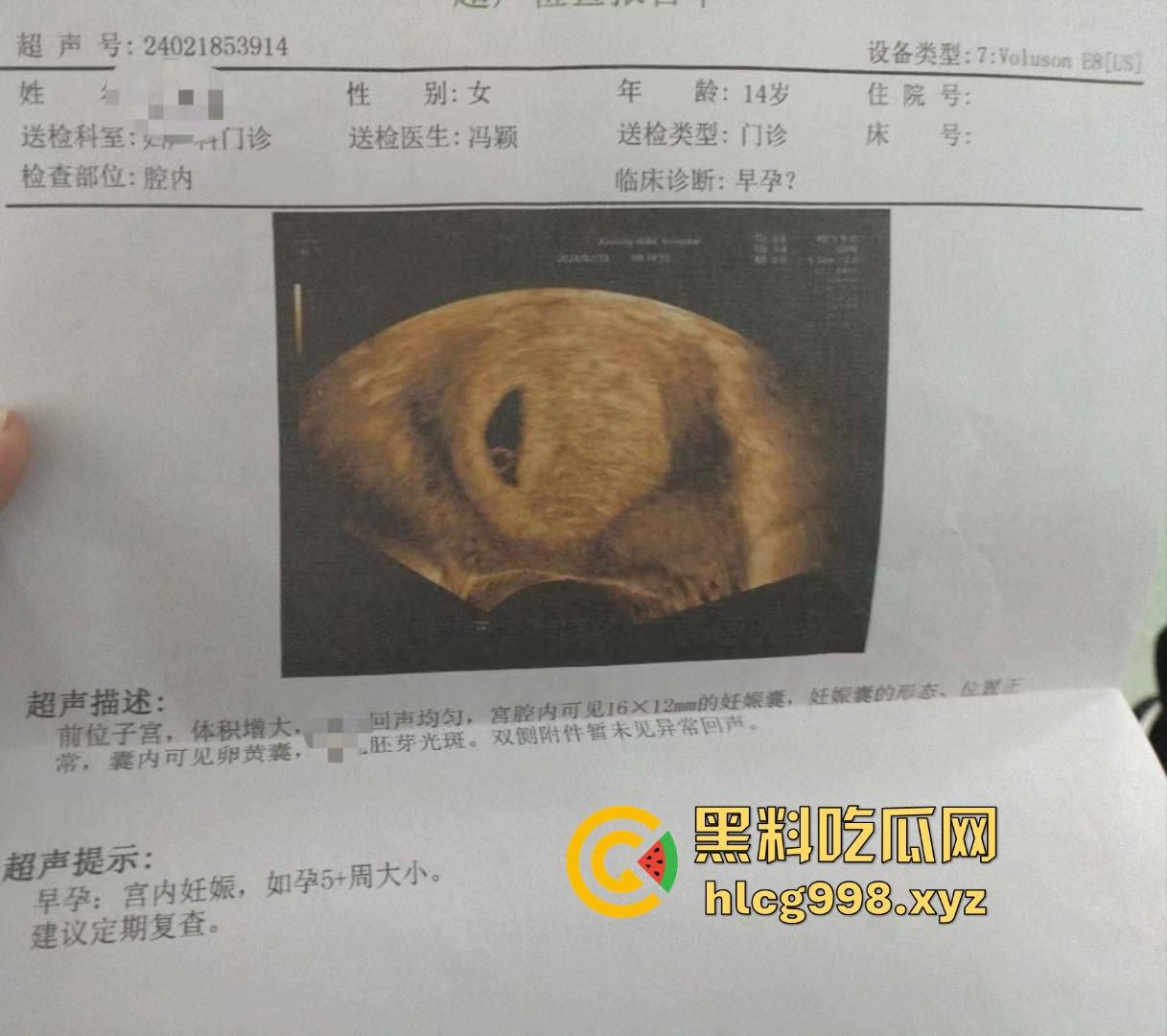 不到18岁小姑娘竟然怀孕!不带套灌满精液,爽完直接奔着5代同堂,真是绝了!-7