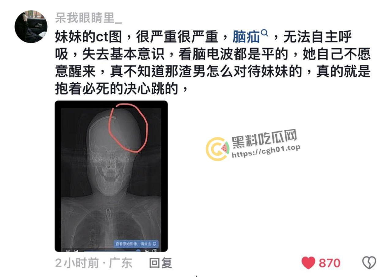 网红二次元妹妹的为爱冲锋！不爱我我就去死 跳楼自杀脑死亡 这么漂亮的妹妹 【朱志明】糊涂啊-4