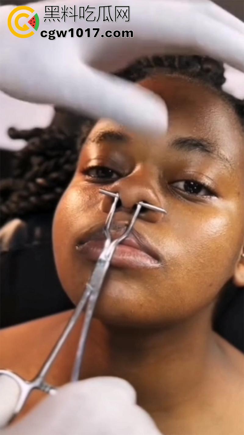 黑人女孩沉浸式穿刺，给鼻子打孔穿鼻环，这玩意不是牛才打的么，黑人竟然也好这口，难道是个小母牛？-1