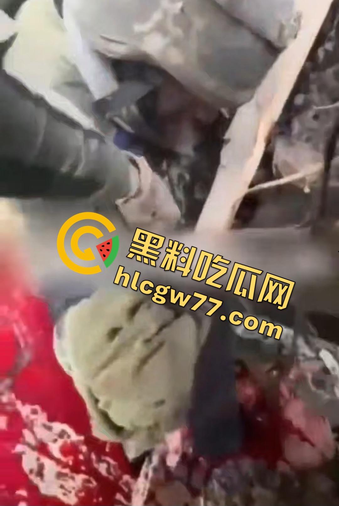俄乌战场出现食人兵？士兵炸弹炸飞手臂骨髓喷溅，一旁队友饿了还吸食血液充饥！-4