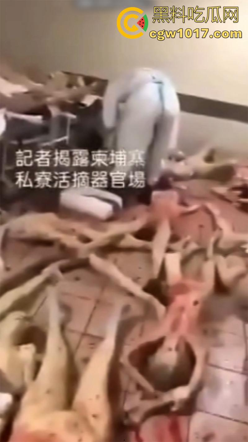 柬埔寨器官交易场实拍，猪仔狗推的最终贩卖地，难怪这里每个人都值钱，只要血型匹配有买主，立刻就会被拉走！-7